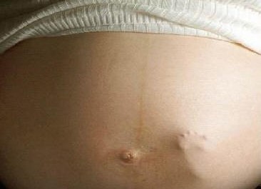 baby foot in mom's belly
